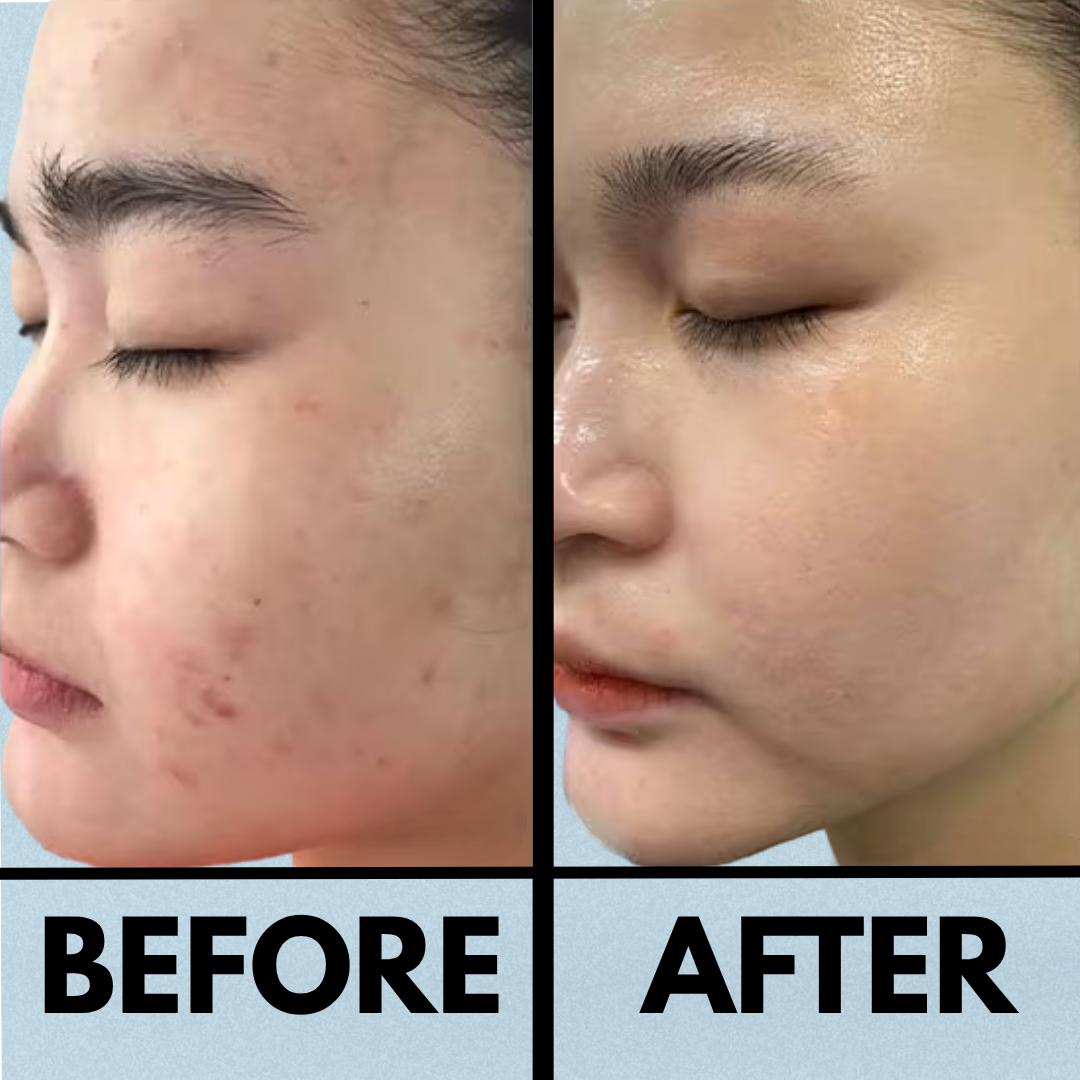 The Korean Rice Peel Shot Duo