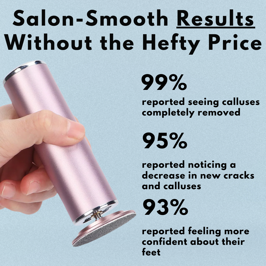 The Original Electric Callus Remover