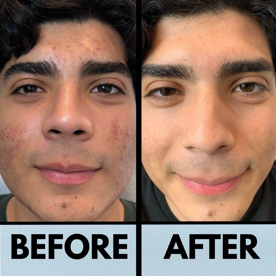 THE KOREAN RICE PEEL SHOT DUO