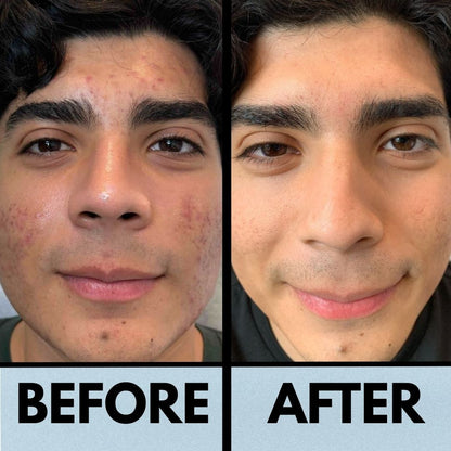 THE KOREAN RICE PEEL SHOT DUO